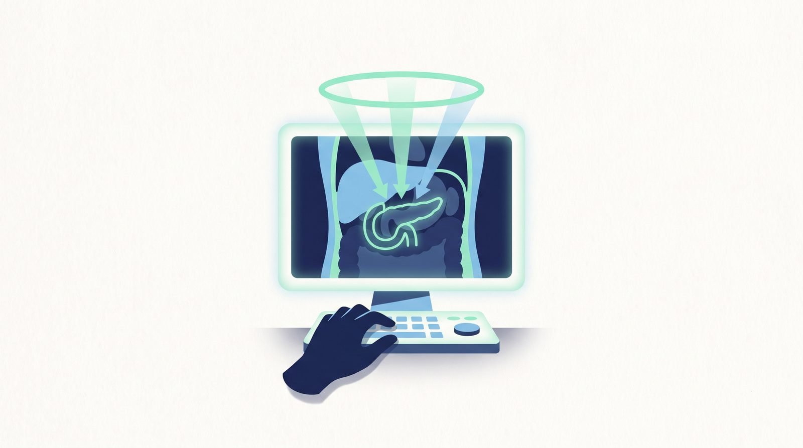 Illustration: an MRI on a monitor with an AI outline tracking the pancreas
